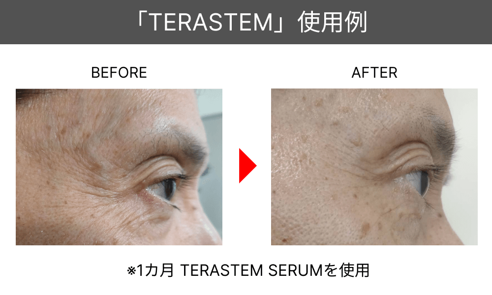 テラステム セラム 2個セット